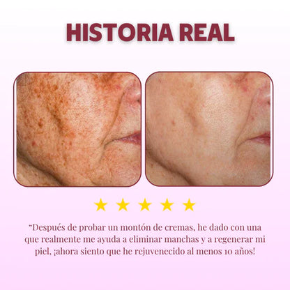 DragonLift™ | Tu misma piel, ¡pero 10 años más joven! | 2x1 | ¡Solo hoy!