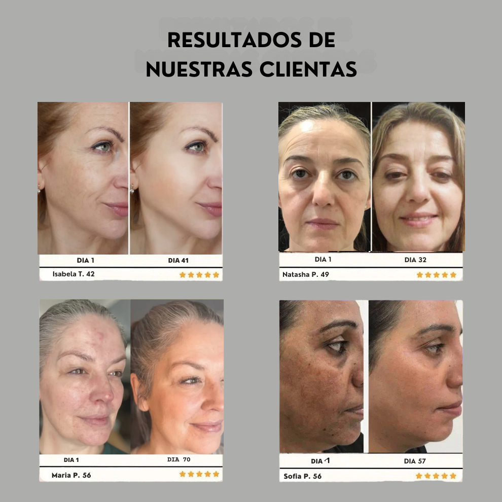 Tu piel, más joven en 7 días con DragonLift™