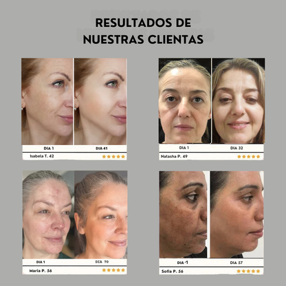 Tu piel, más joven en 7 días con DragonLift™