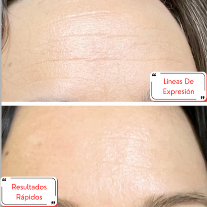 Tu piel, más joven en 7 días con DragonLift™